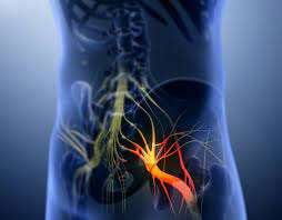 ما هو عرق النسا؟